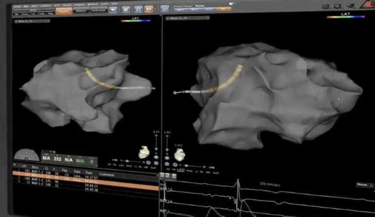 Read more about the article You Know They Put Wires In Your Heart, Right? (carto vizigo)