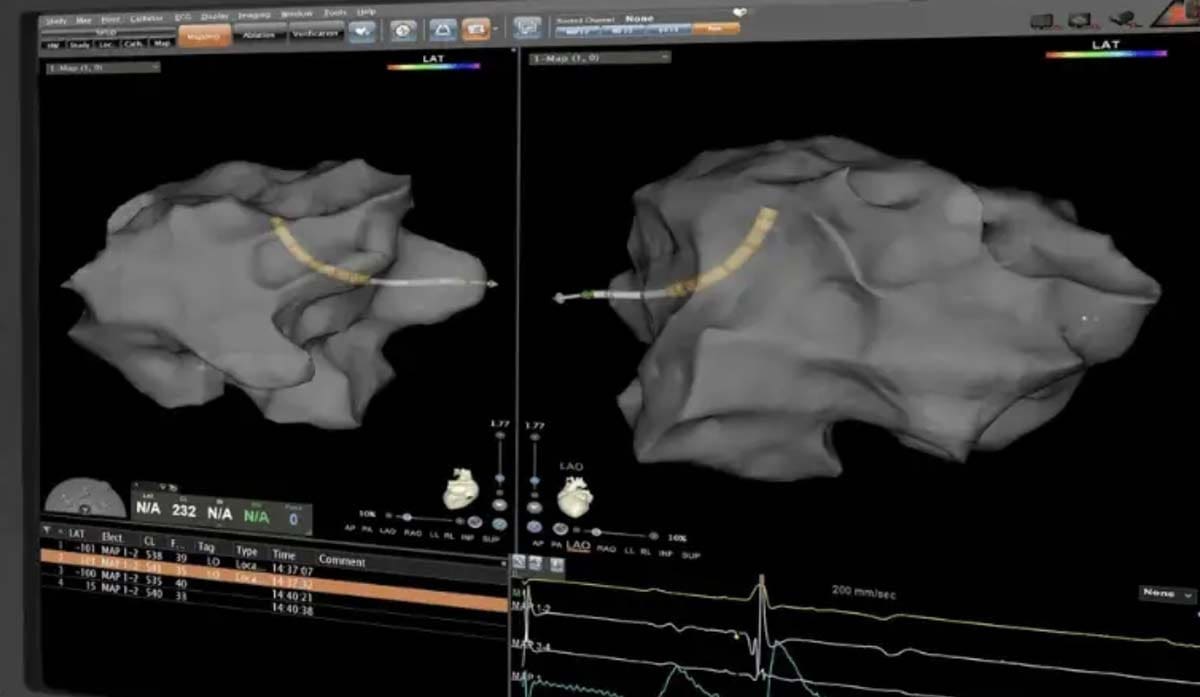 Read more about the article You Know They Put Wires In Your Heart, Right? (carto vizigo)