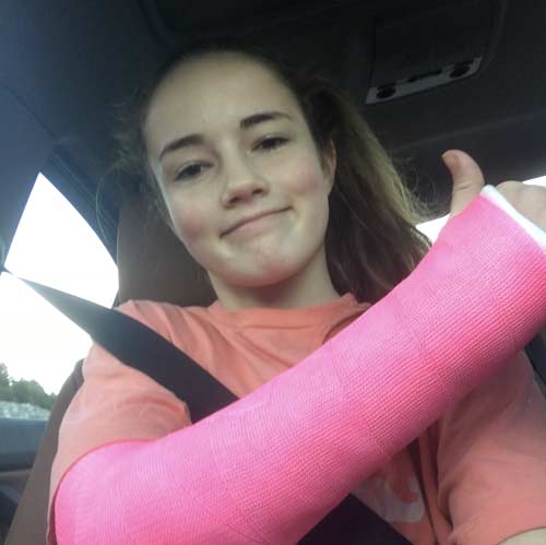 my daughter's broken arm